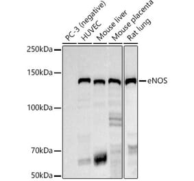 Western Blot - Anti-eNOS Antibody [ARC51618] (A306395) - Antibodies.com