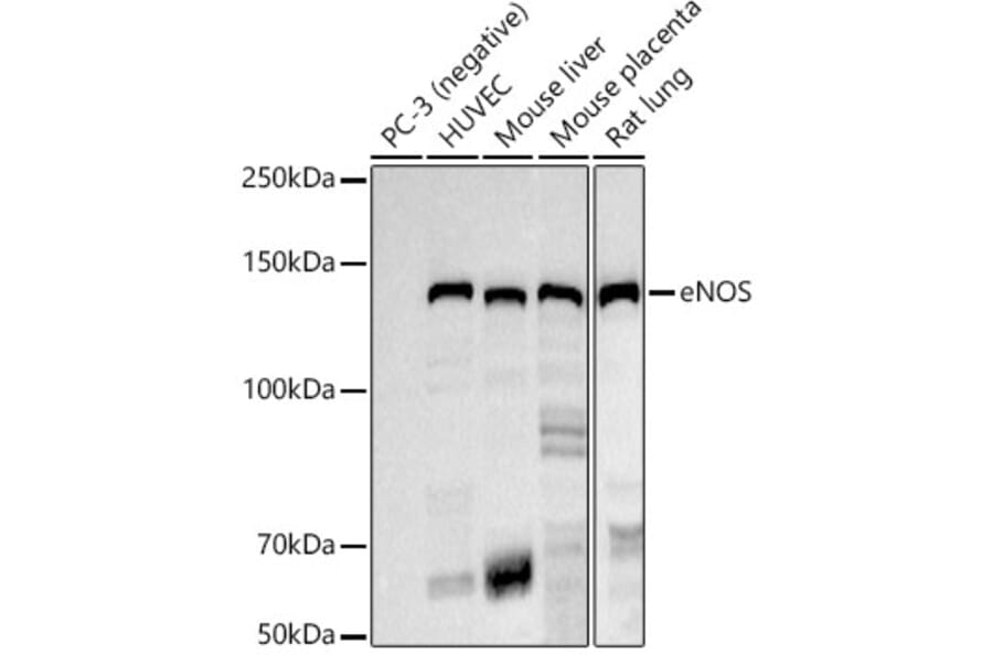 Western Blot - Anti-eNOS Antibody [ARC51618] (A306395) - Antibodies.com