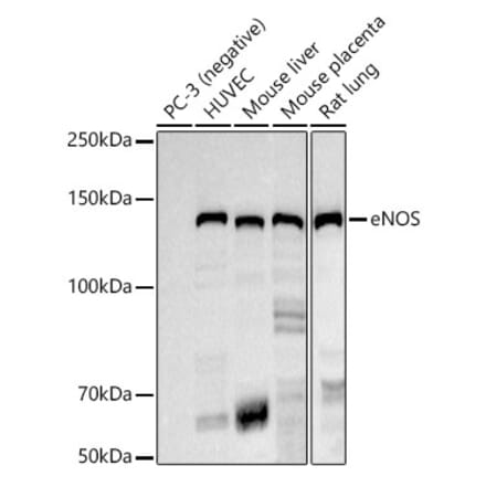 Western Blot - Anti-eNOS Antibody [ARC51618] (A306395) - Antibodies.com