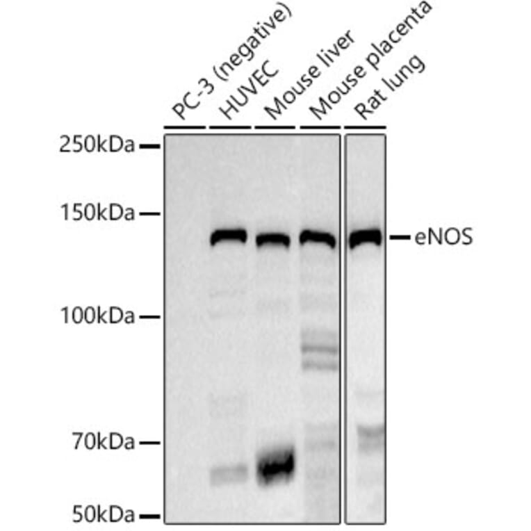 Western Blot - Anti-eNOS Antibody [ARC51618] (A306395) - Antibodies.com