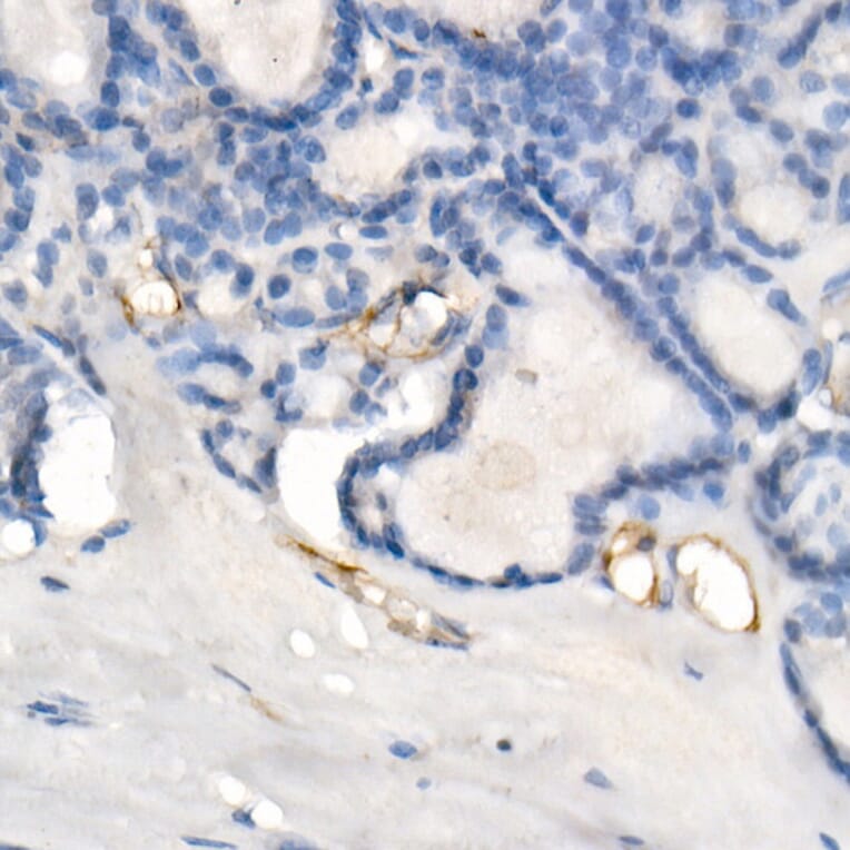 Immunohistochemistry - Anti-eNOS Antibody [ARC51618] (A306395) - Antibodies.com