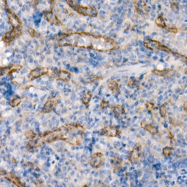Immunohistochemistry - Anti-eNOS Antibody [ARC51618] (A306395) - Antibodies.com