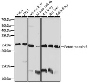 Western Blot - Anti-Peroxiredoxin 6 Antibody [ARC0954] (A306396) - Antibodies.com