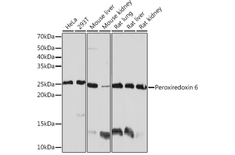 Western Blot - Anti-Peroxiredoxin 6 Antibody [ARC0954] (A306396) - Antibodies.com