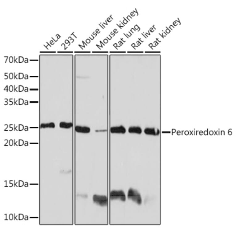 Western Blot - Anti-Peroxiredoxin 6 Antibody [ARC0954] (A306396) - Antibodies.com