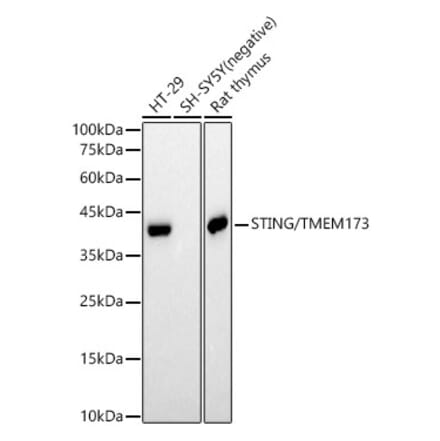 Western Blot - Anti-STING Antibody [ARC57967] (A306397) - Antibodies.com