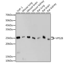 Western Blot - Anti-VPS28 Antibody [ARC2399] (A306398) - Antibodies.com