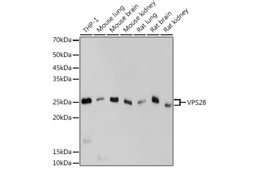Western Blot - Anti-VPS28 Antibody [ARC2399] (A306398) - Antibodies.com