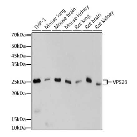 Western Blot - Anti-VPS28 Antibody [ARC2399] (A306398) - Antibodies.com