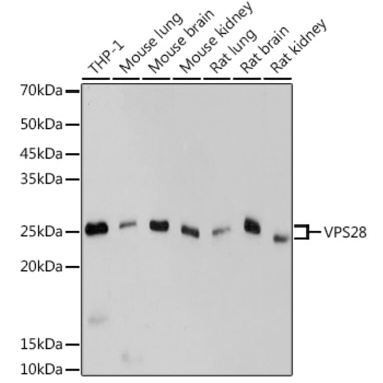 Western Blot - Anti-VPS28 Antibody [ARC2399] (A306398) - Antibodies.com