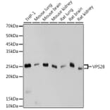 Western Blot - Anti-VPS28 Antibody [ARC2399] (A306398) - Antibodies.com