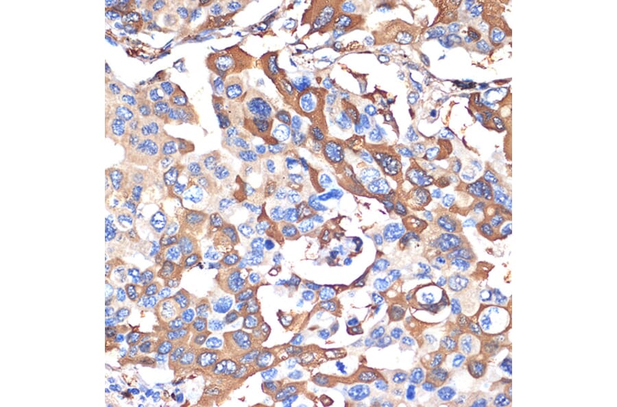 Immunohistochemistry - Anti-VPS28 Antibody [ARC2399] (A306398) - Antibodies.com