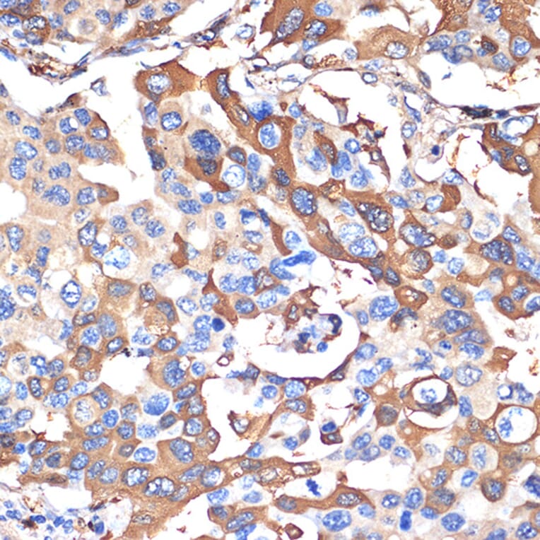 Immunohistochemistry - Anti-VPS28 Antibody [ARC2399] (A306398) - Antibodies.com