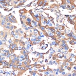 Immunohistochemistry - Anti-VPS28 Antibody [ARC2399] (A306398) - Antibodies.com