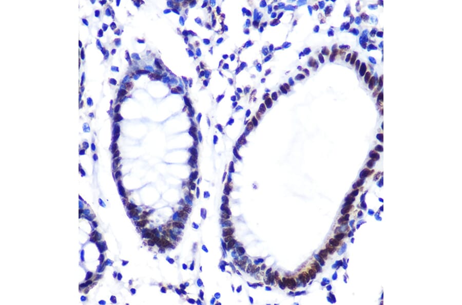 Immunohistochemistry - Anti-Histone H2A Antibody [ARC0253] (A306399) - Antibodies.com