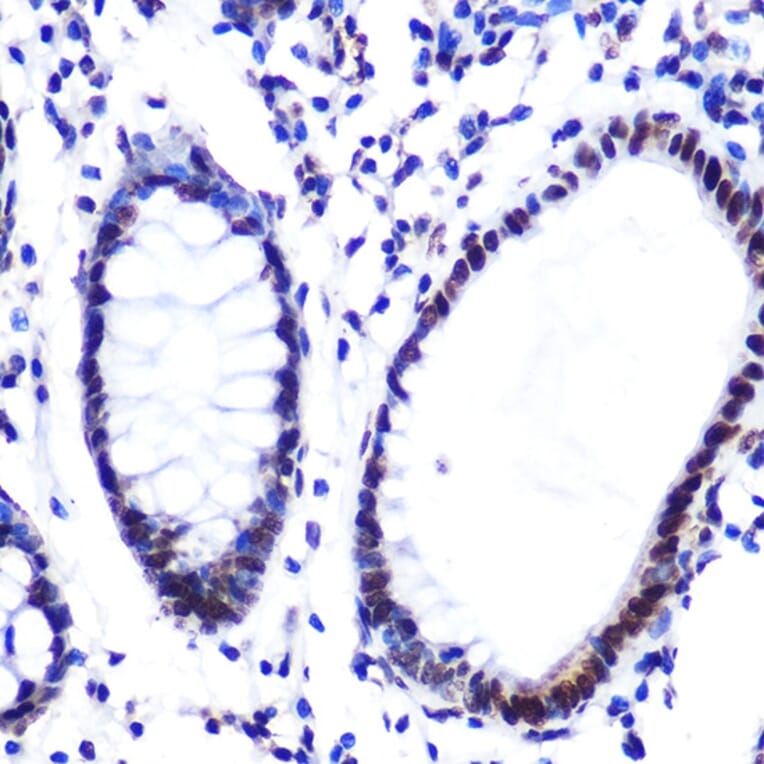 Immunohistochemistry - Anti-Histone H2A Antibody [ARC0253] (A306399) - Antibodies.com