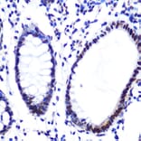 Immunohistochemistry - Anti-Histone H2A Antibody [ARC0253] (A306399) - Antibodies.com