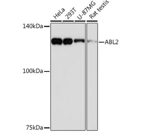 Western Blot - Anti-ABL2 Antibody [ARC2200] (A306400) - Antibodies.com