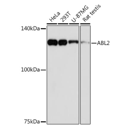 Western Blot - Anti-ABL2 Antibody [ARC2200] (A306400) - Antibodies.com