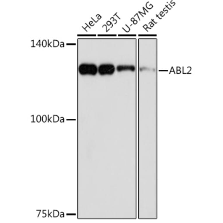 Western Blot - Anti-ABL2 Antibody [ARC2200] (A306400) - Antibodies.com