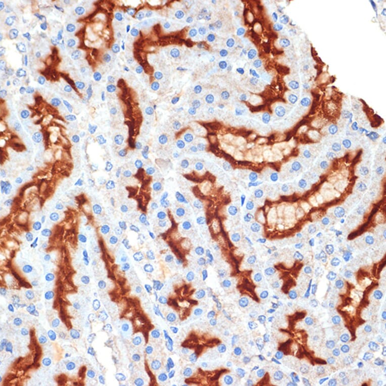 Immunohistochemistry - Anti-Syntaxin 3 Antibody [ARC2081] (A306403) - Antibodies.com