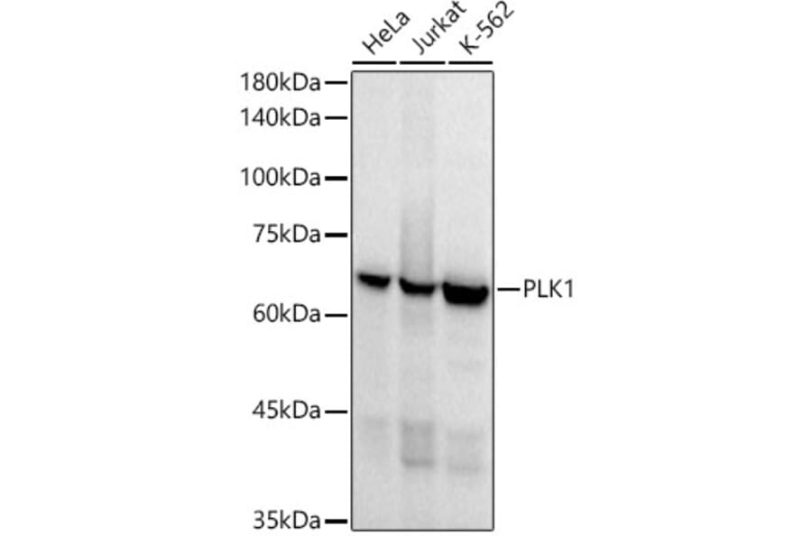 Western Blot - Anti-PLK1 Antibody [ARC52311] (A306404) - Antibodies.com
