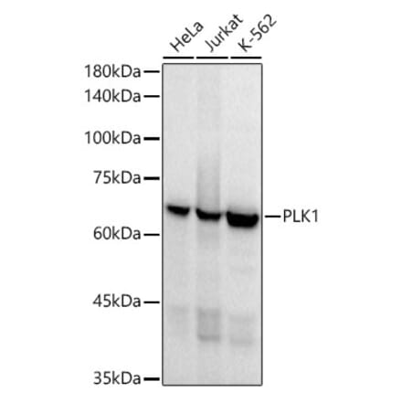 Western Blot - Anti-PLK1 Antibody [ARC52311] (A306404) - Antibodies.com