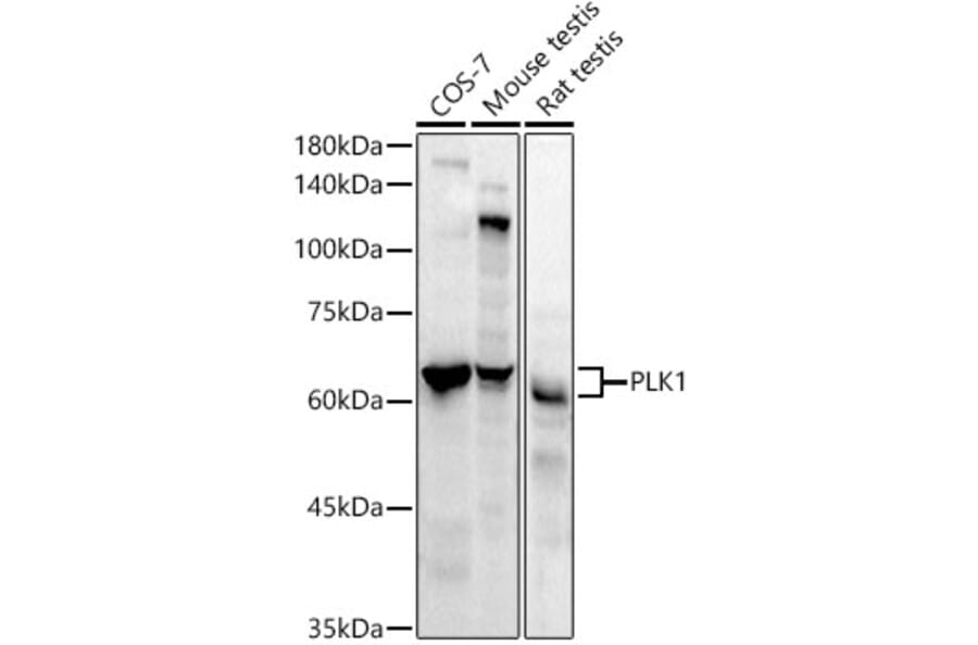 Western Blot - Anti-PLK1 Antibody [ARC52311] (A306404) - Antibodies.com