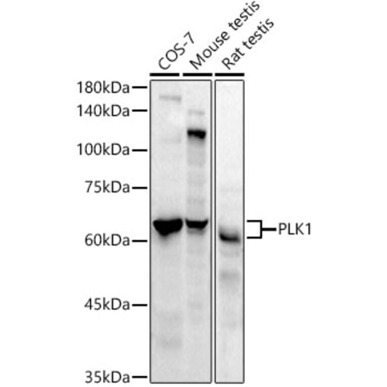 Western Blot - Anti-PLK1 Antibody [ARC52311] (A306404) - Antibodies.com