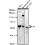 Western Blot - Anti-PLK1 Antibody [ARC52311] (A306404) - Antibodies.com