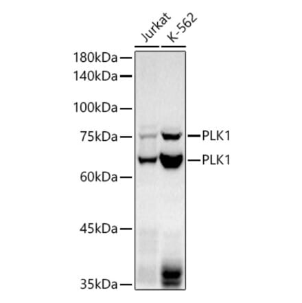 Western Blot - Anti-PLK1 Antibody [ARC52313] (A306405) - Antibodies.com