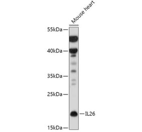 Western Blot - Anti-IL-26 Antibody (A306406) - Antibodies.com