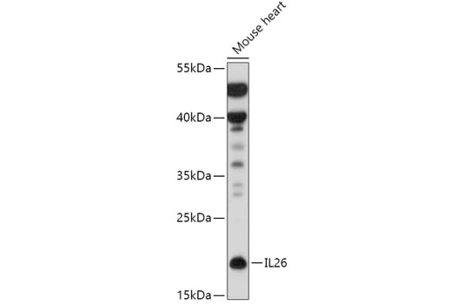 Western Blot - Anti-IL-26 Antibody (A306406) - Antibodies.com
