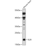Western Blot - Anti-IL-26 Antibody (A306406) - Antibodies.com