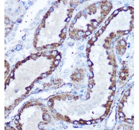 Immunohistochemistry - Anti-SOD2/MnSOD Antibody (A306407) - Antibodies.com