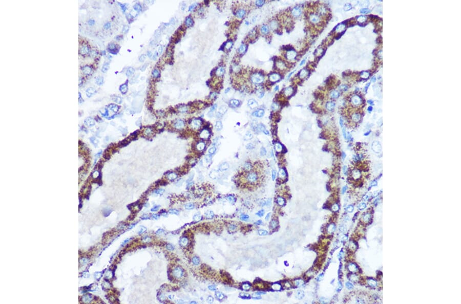 Immunohistochemistry - Anti-SOD2/MnSOD Antibody (A306407) - Antibodies.com