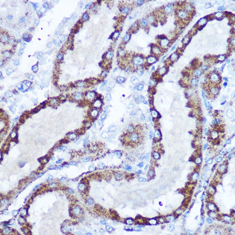 Immunohistochemistry - Anti-SOD2/MnSOD Antibody (A306407) - Antibodies.com