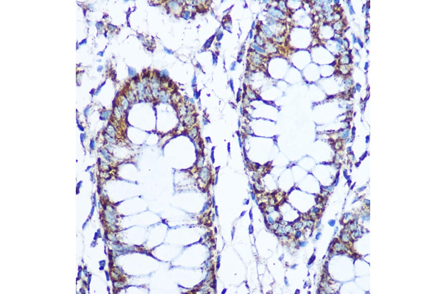 Immunohistochemistry - Anti-SOD2/MnSOD Antibody (A306407) - Antibodies.com