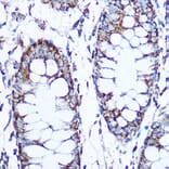 Immunohistochemistry - Anti-SOD2/MnSOD Antibody (A306407) - Antibodies.com
