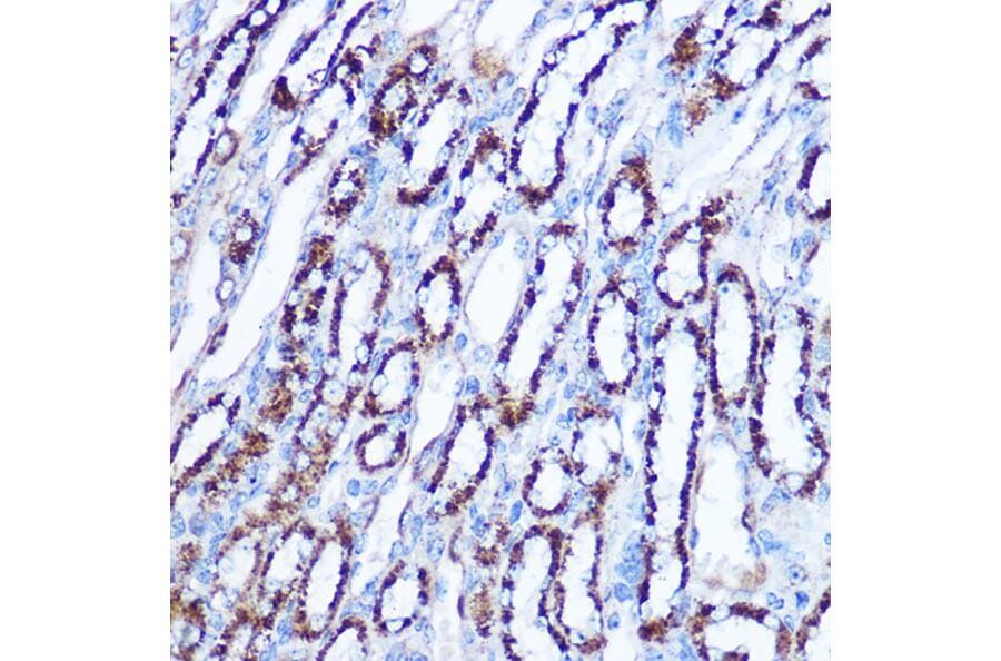 Immunohistochemistry - Anti-SOD2/MnSOD Antibody (A306407) - Antibodies.com