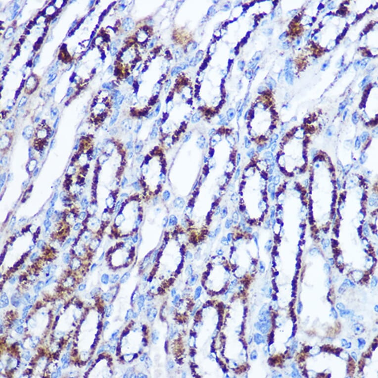 Immunohistochemistry - Anti-SOD2/MnSOD Antibody (A306407) - Antibodies.com