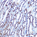 Immunohistochemistry - Anti-SOD2/MnSOD Antibody (A306407) - Antibodies.com