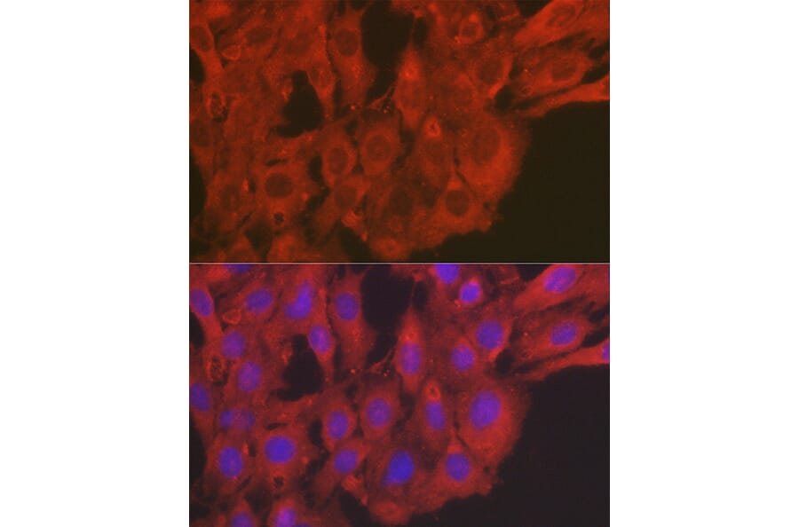 Immunofluorescence - Anti-SOD2/MnSOD Antibody (A306407) - Antibodies.com