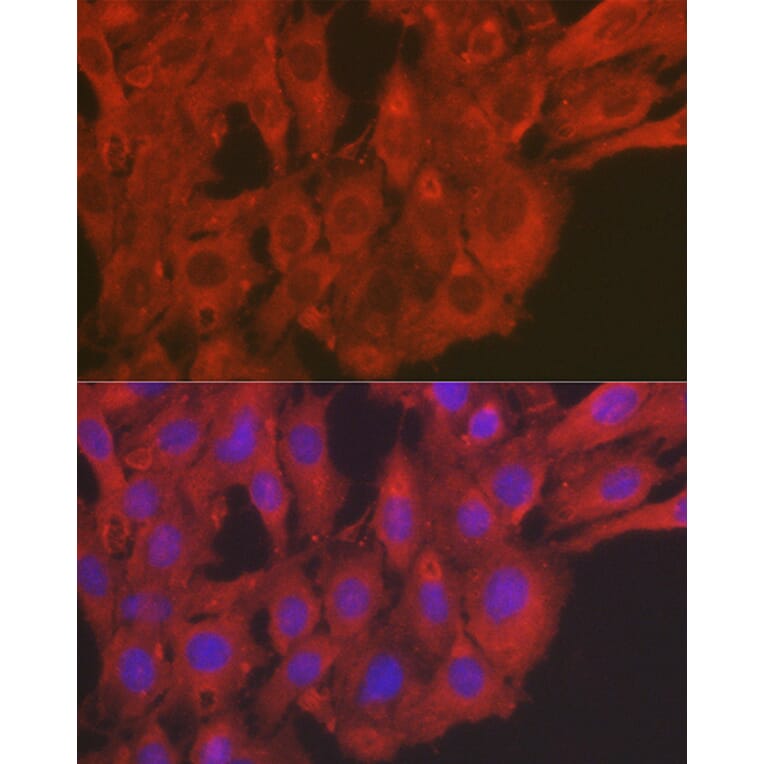 Immunofluorescence - Anti-SOD2/MnSOD Antibody (A306407) - Antibodies.com