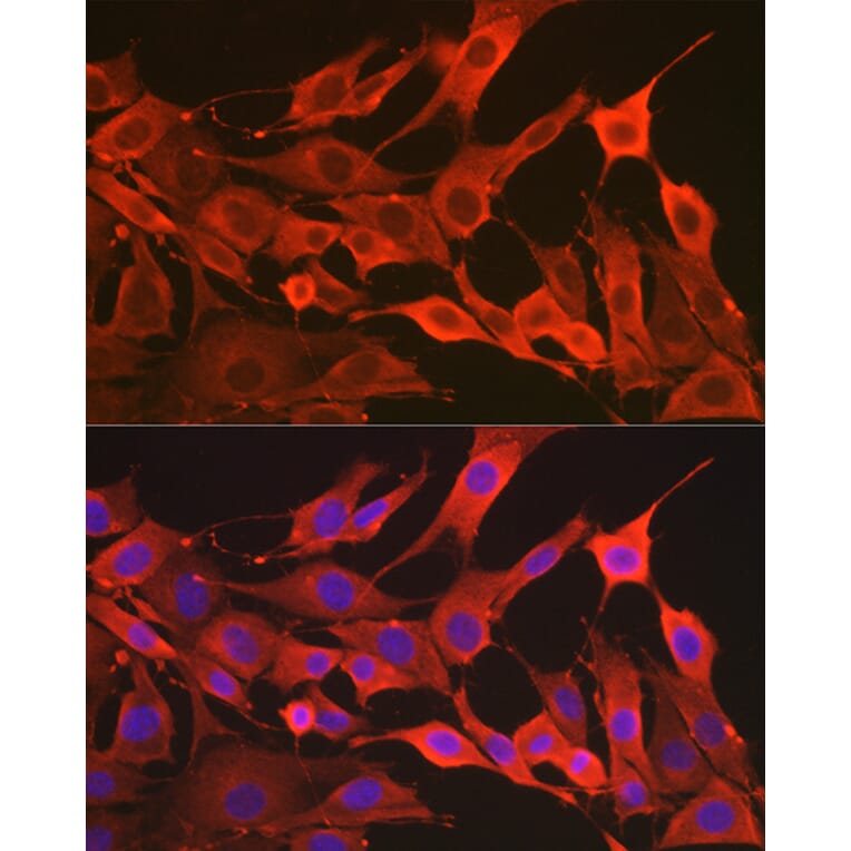 Immunofluorescence - Anti-SOD2/MnSOD Antibody (A306407) - Antibodies.com