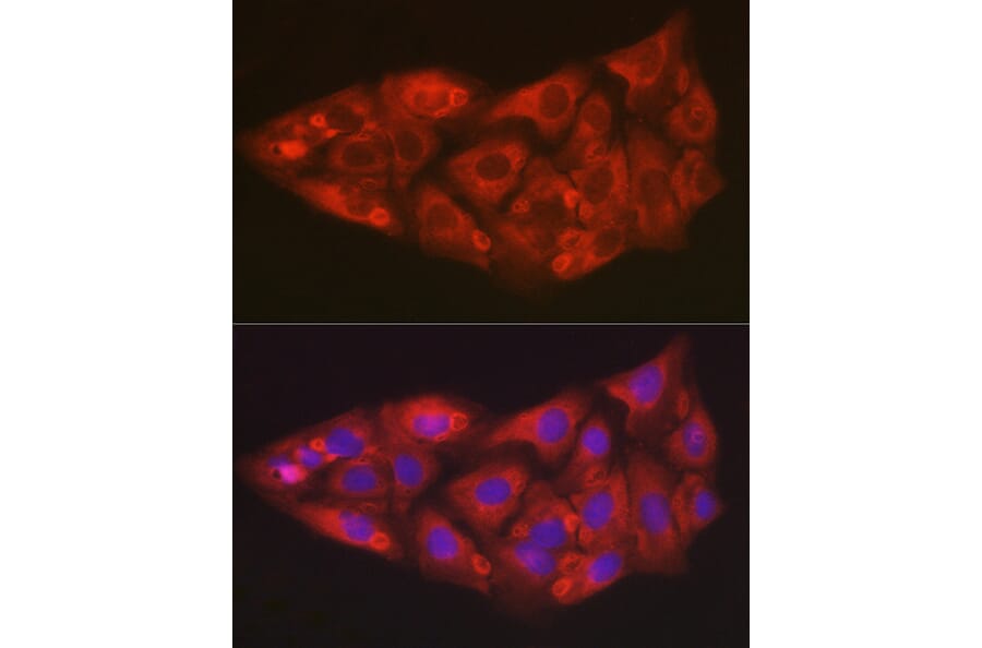 Immunofluorescence - Anti-SOD2/MnSOD Antibody (A306407) - Antibodies.com