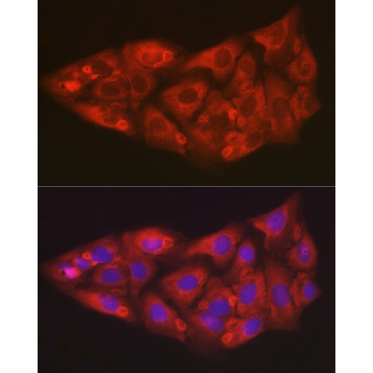 Immunofluorescence - Anti-SOD2/MnSOD Antibody (A306407) - Antibodies.com