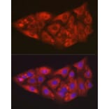 Immunofluorescence - Anti-SOD2/MnSOD Antibody (A306407) - Antibodies.com