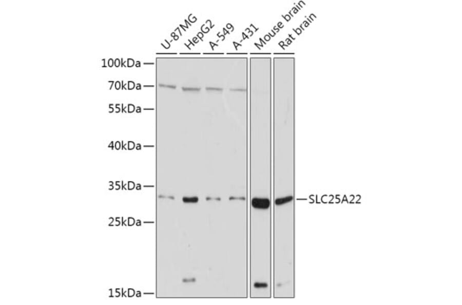 Western Blot - Anti-GC-1 Antibody (A306408) - Antibodies.com