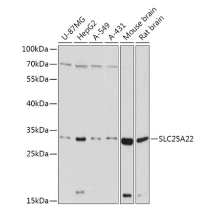 Western Blot - Anti-GC-1 Antibody (A306408) - Antibodies.com
